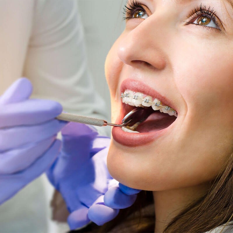 Woman with Braces at Orthodontic Appointment